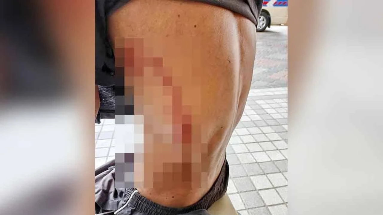 Warga Emas Patah Tulang Rusuk Ditanduk Lembu Korban