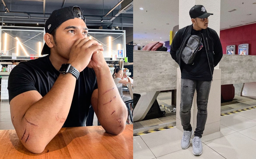Hirisan Di Tangan Tak Sesakit Hirisan Bekas Isteri Yang Diceraikan Muat Naik Foto Tangan Calar Luka Pu Abu Undang Komen Kecaman Daripada Netizen Gempak