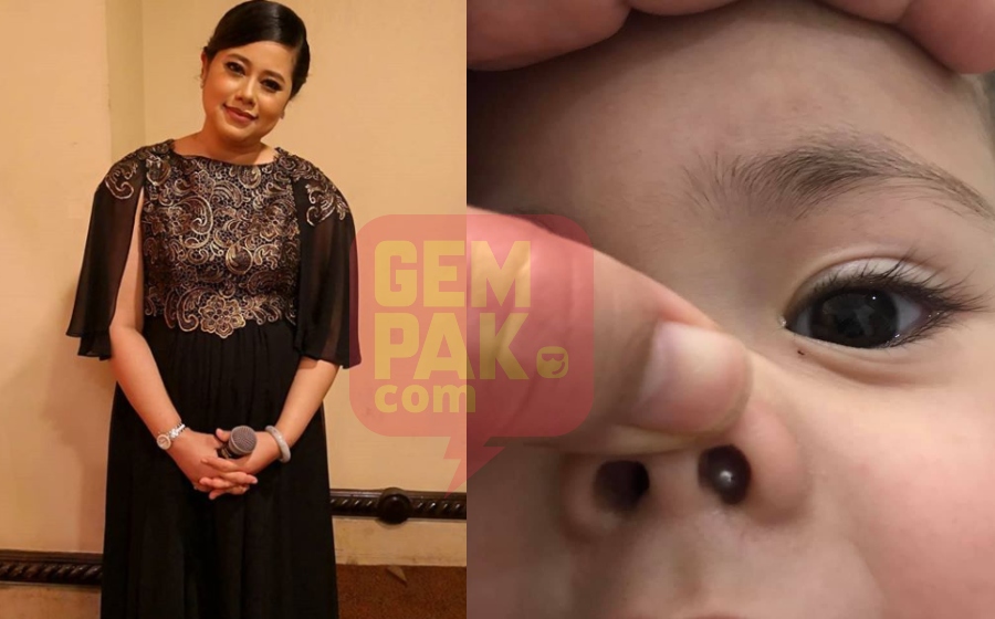 Panik! Hidung Anak Dimasuki Manik, Farhan Terpaksaâ¦