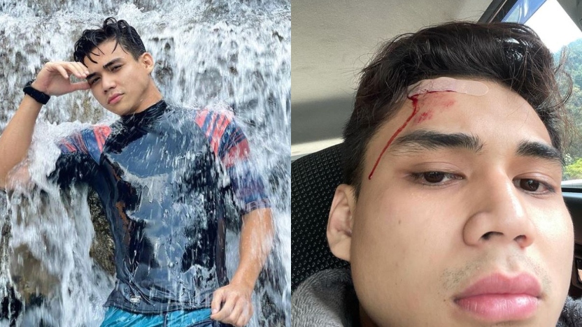 “Pendarahan, Rasa Pening Nak Pitam…”- Terhentak Batu Ketika Mandi Di Sungai, Raja Atiq Kena 5 Jahitan