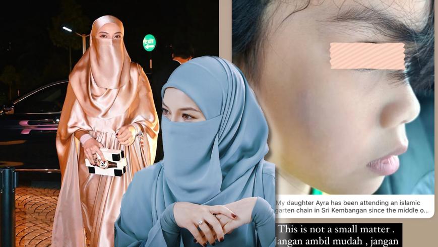 "Ini Bukan Isu Yang Remeh..."- Isu Budak Tadika Kena Buli, Neelofa Gesa Pihak Sekolah Ambil Tindakan