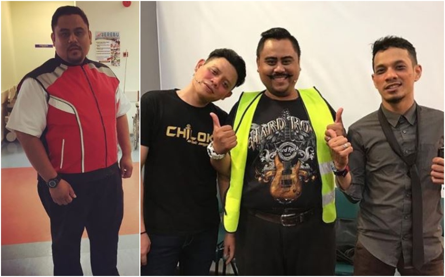 Kamal Chilok Kemalangan, Kritikal Di Hospital Putrajaya