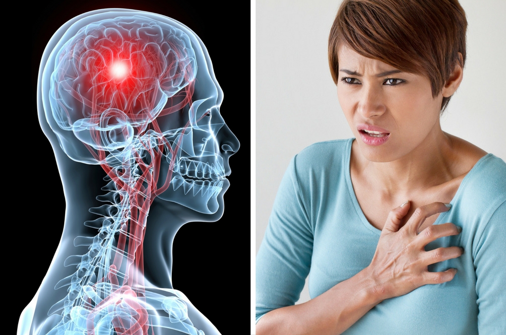 Bersukan Guna Raket Cegah Sakit Jantung, Strok | Lifestyle | Rojak Daily