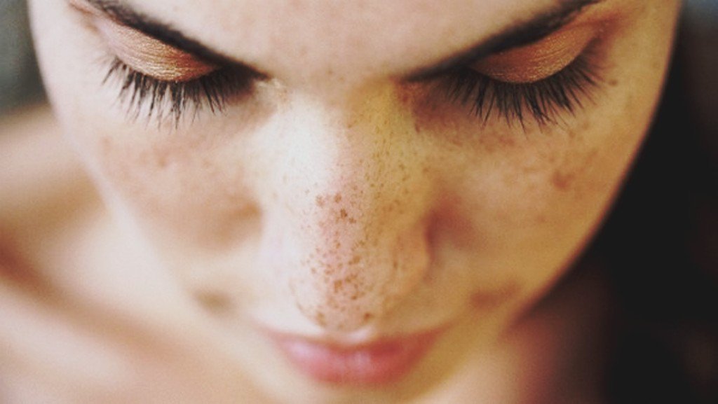 beautyhealthtips.in Black spots, deep-pitted scars, acne scars, and the list goes on.