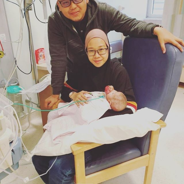 @_nrlerwani Instagram Baby Ainul and her parents before the surgery.