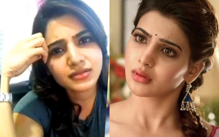 Is Actress Samantha Suffering From This Sickness? Here's What She Did