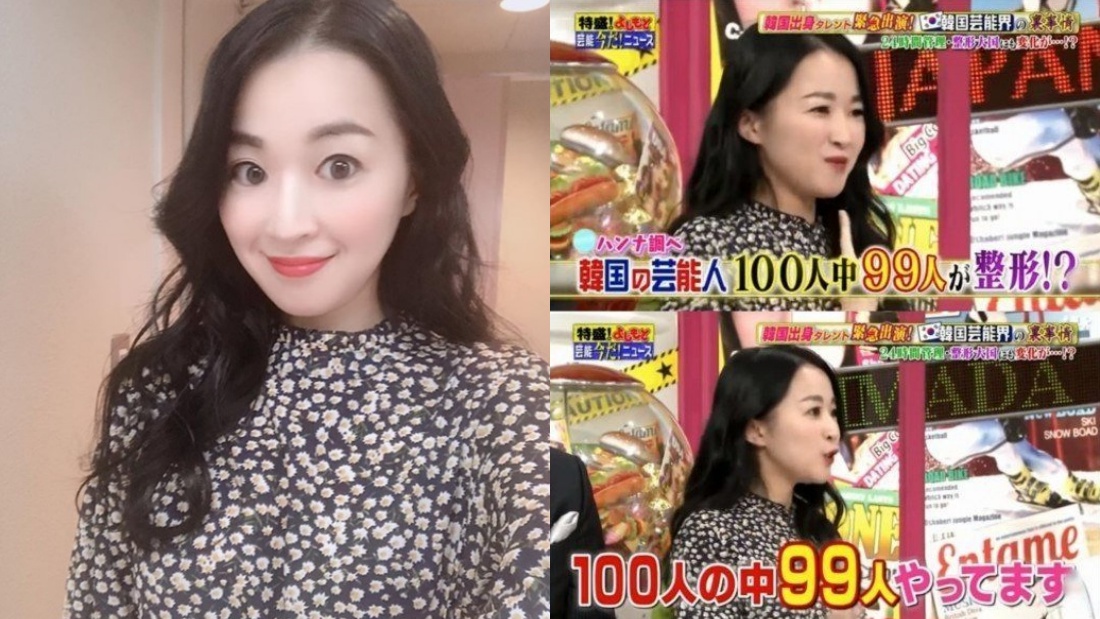 称99 艺人都曾整容 女星 在韩国很常见 聊八卦 Xuan Com My