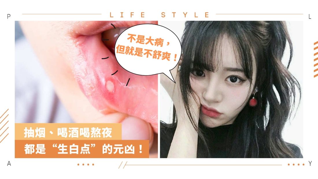 生活i 嘴巴总是 生白点 多吃鸡蛋和牛奶可以帮助修复 Xuan