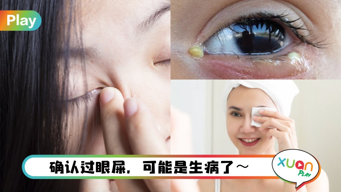 健康I 睡醒眼屎未必是热气,可能暗示这3种身体疾病! | XUAN